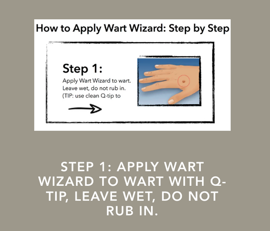 Wart Wizard